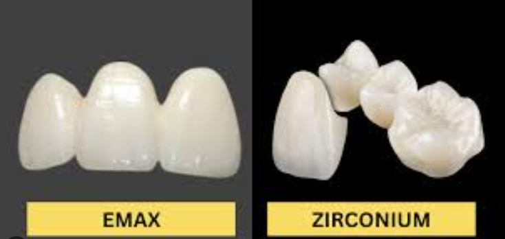 emax vs zircon.png
