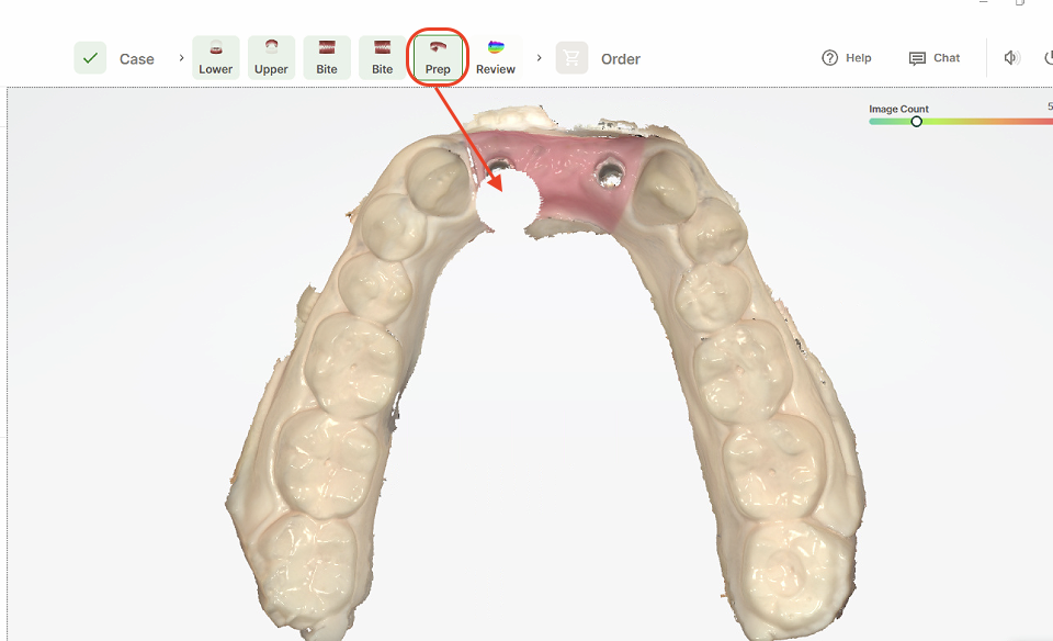 Image Depicting Trimmed Scan Data in Dandy Chairside