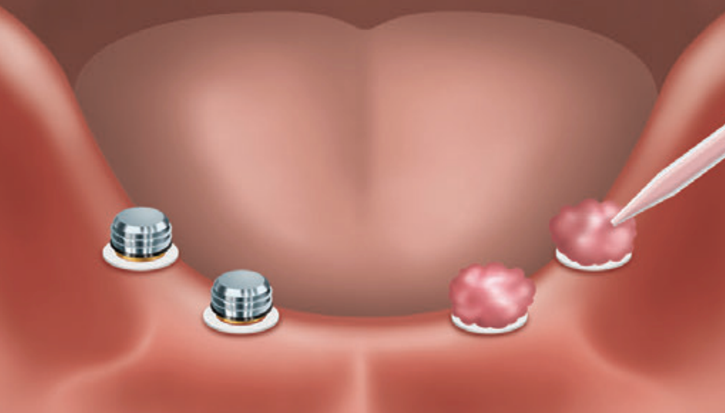 blob-2.png